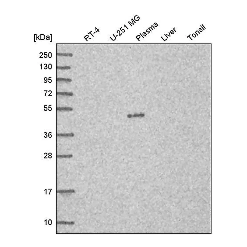 Atlas Antibodies Anti-C7orf25 Antibody
