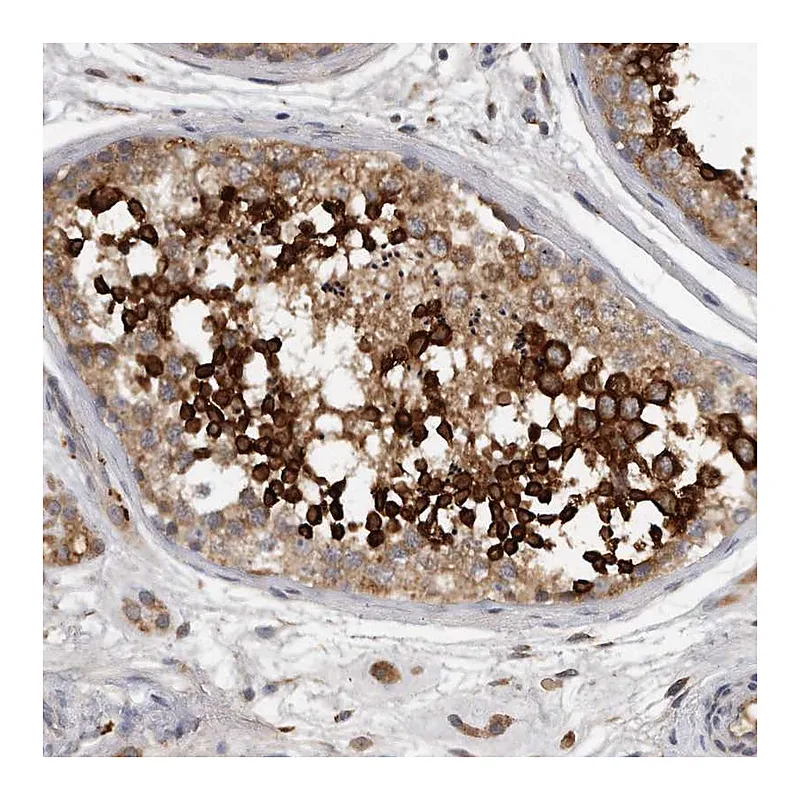 Atlas Antibodies Anti-C7orf43 Antibody