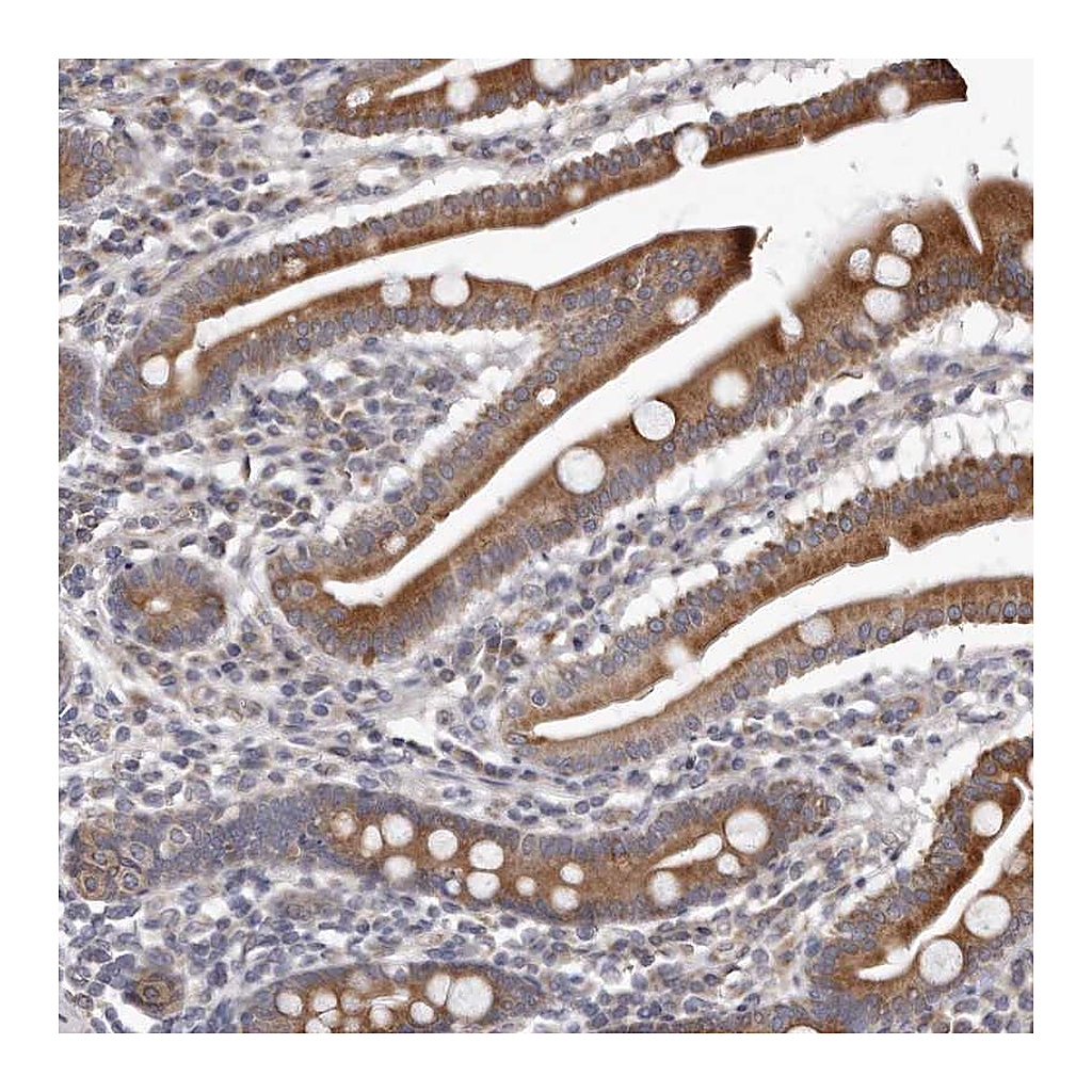 Atlas Antibodies Anti-C7orf43 Antibody