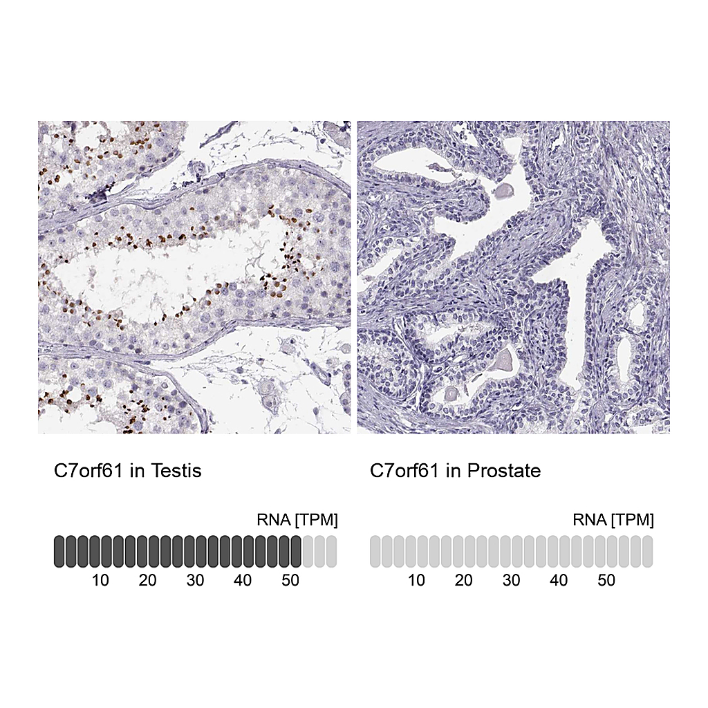 Atlas Antibodies Anti-C7orf61 Antibody