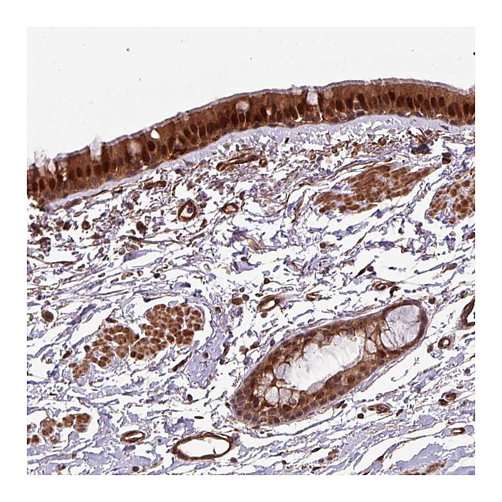 Atlas Antibodies Anti-C7orf50 Antibody