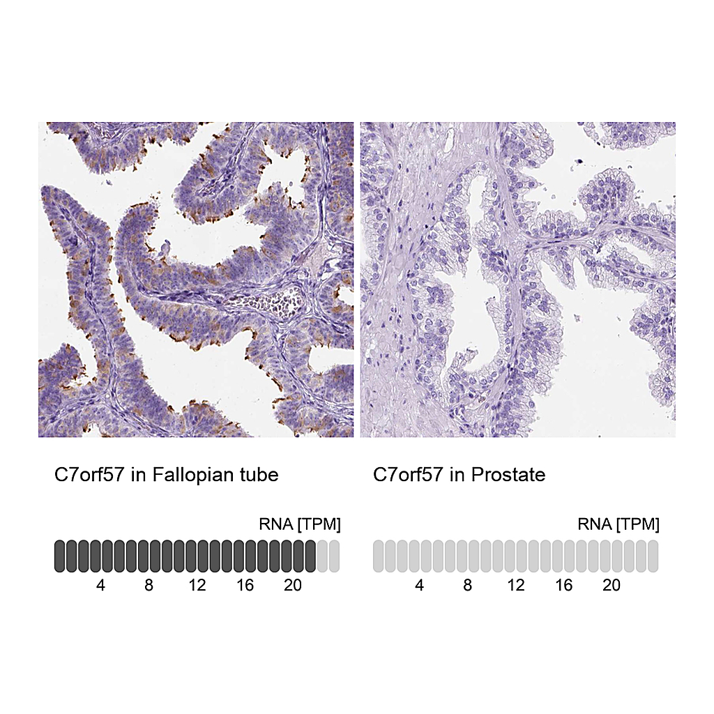 Atlas Antibodies Anti-C7orf57 Antibody