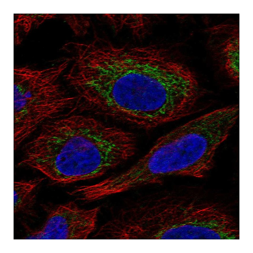 Atlas Antibodies Anti-C7orf73 Antibody