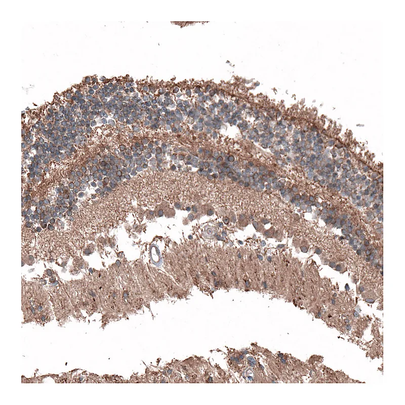 Atlas Antibodies Anti-C8orf37 Antibody