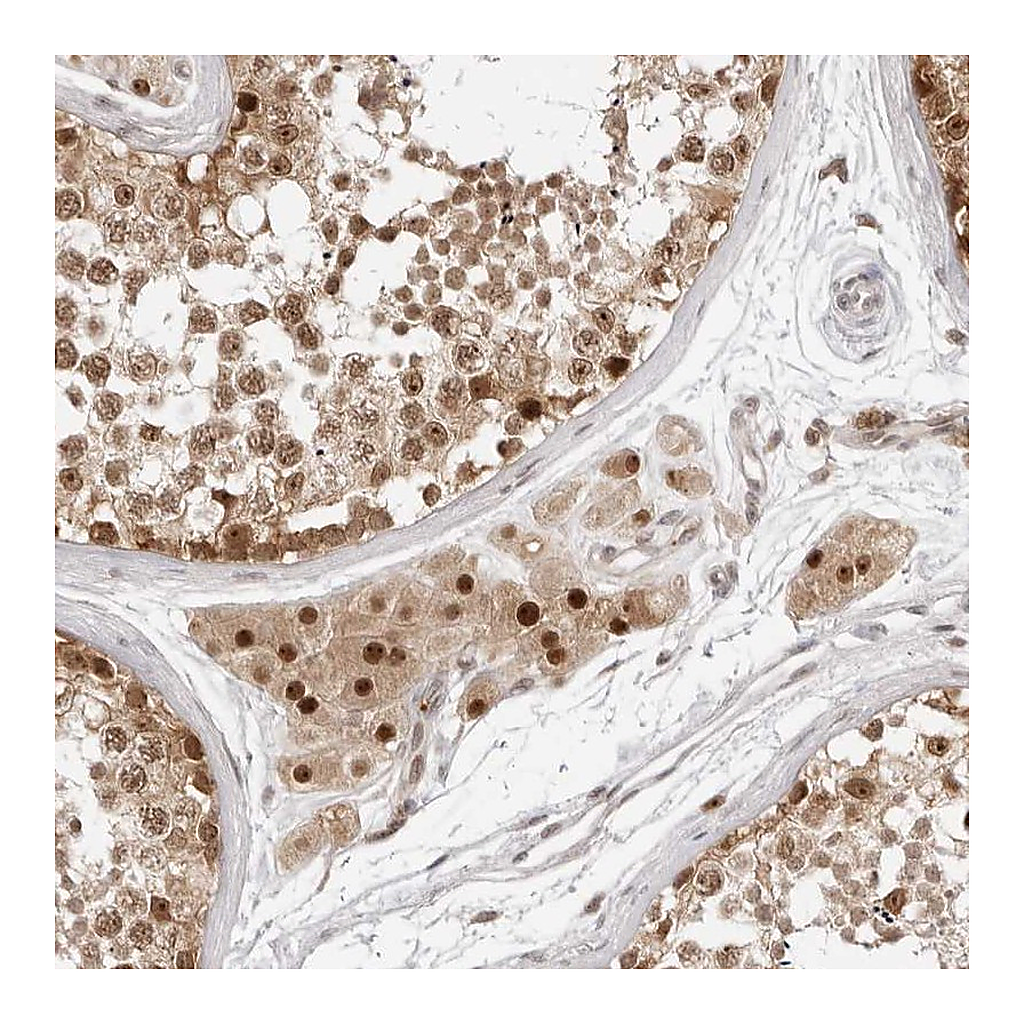 Atlas Antibodies Anti-C8orf48 Antibody
