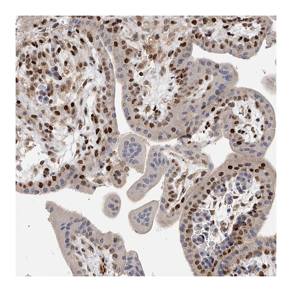 Atlas Antibodies Anti-C8orf58 Antibody