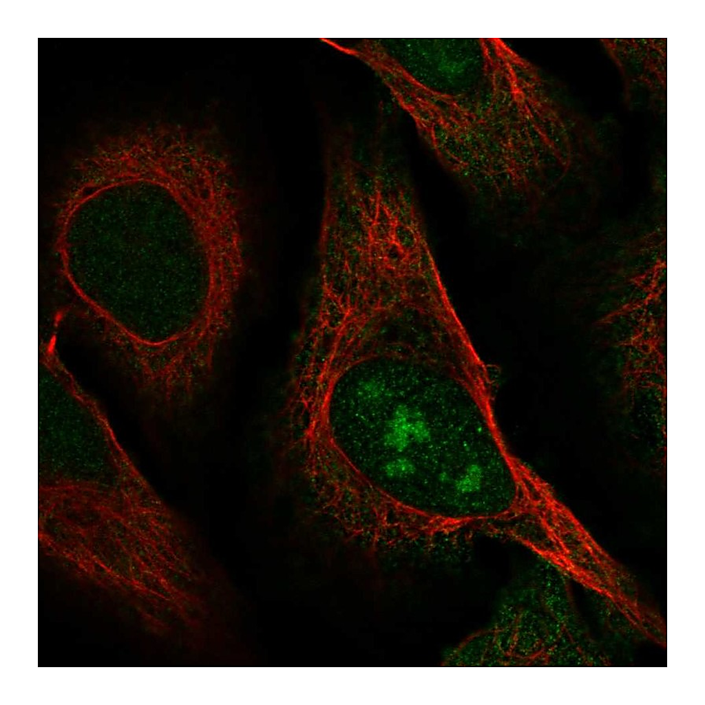 Atlas Antibodies Anti-C8orf59 Antibody