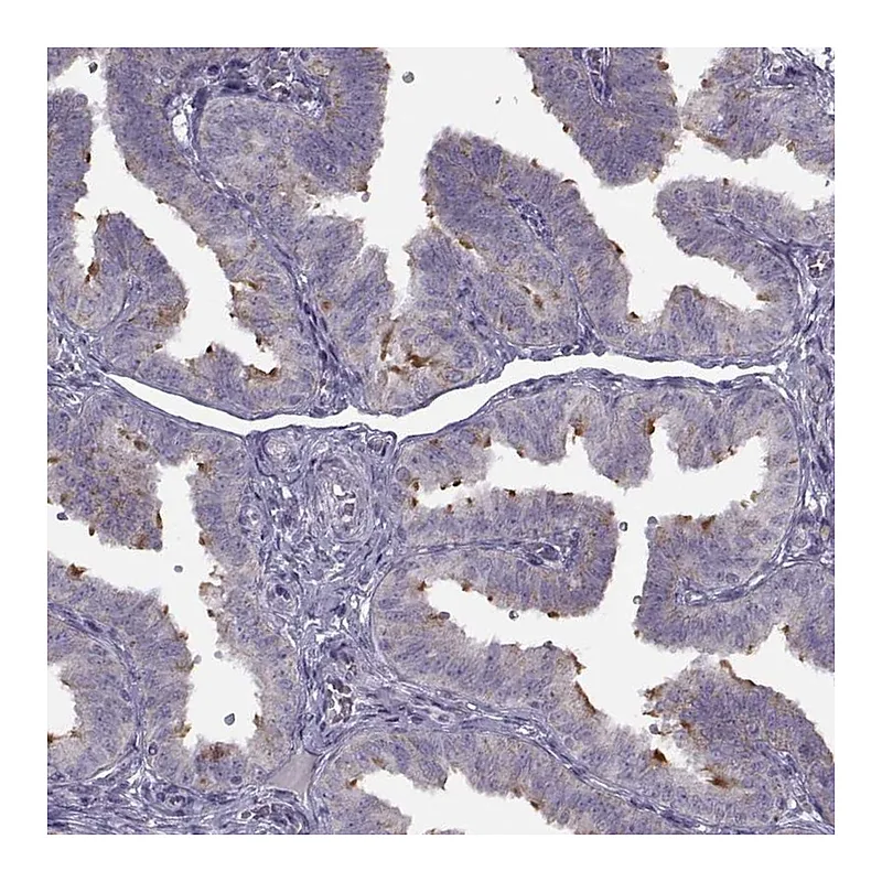Atlas Antibodies Anti-C9orf116 Antibody