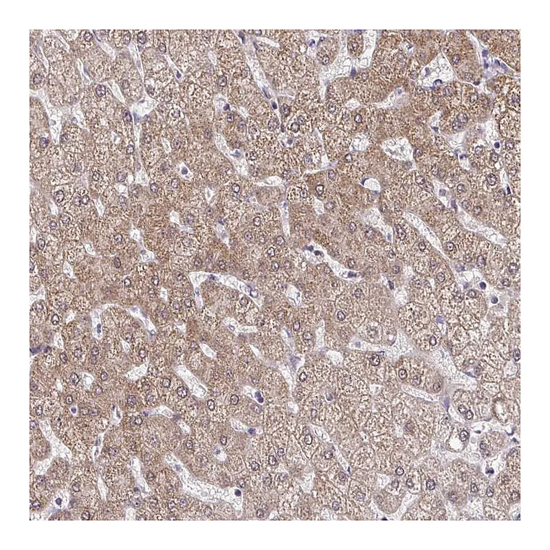 Atlas Antibodies Anti-C9orf64 Antibody