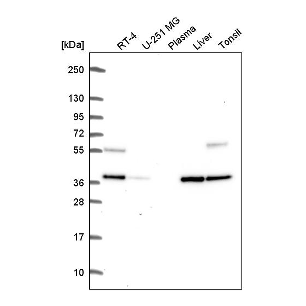 Atlas Antibodies Anti-C9orf64 Antibody