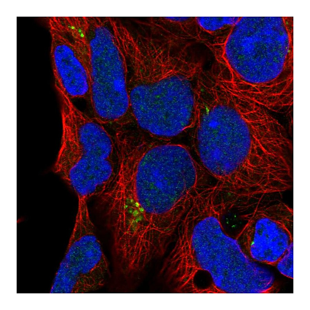 Atlas Antibodies Anti-C9orf85 Antibody
