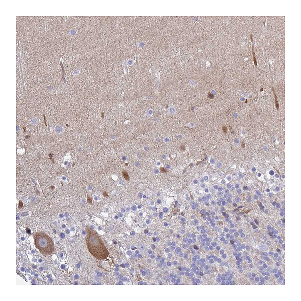 Atlas Antibodies Anti-CA10 Antibody