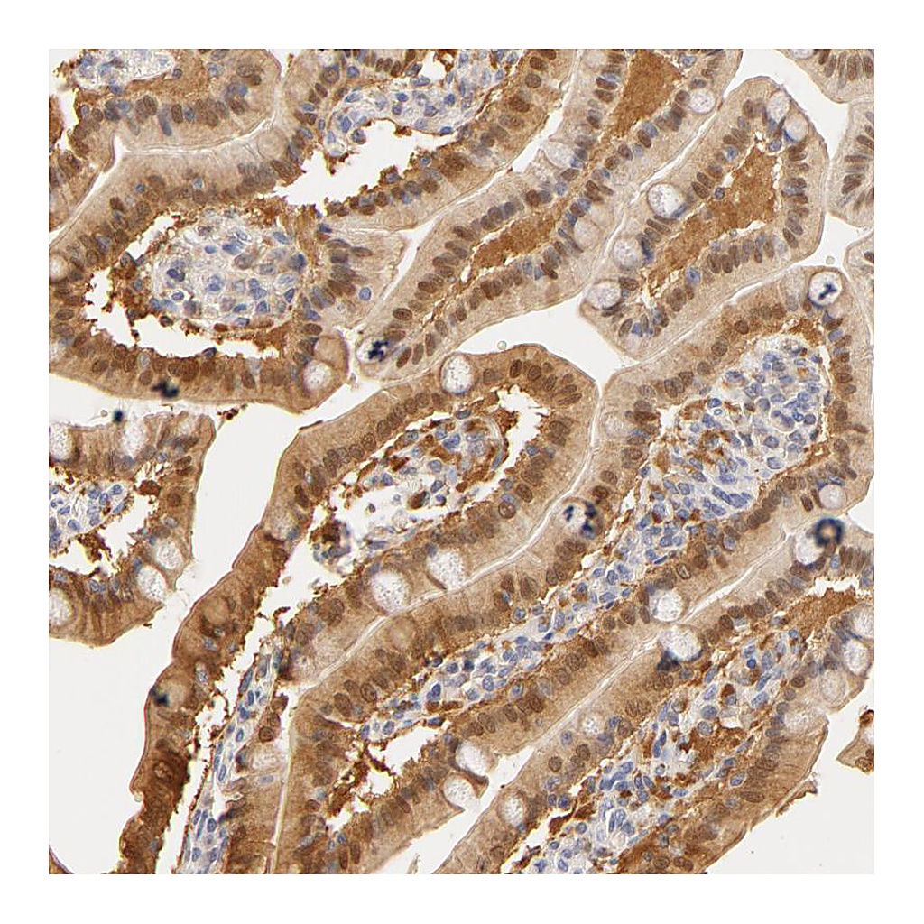 Atlas Antibodies Anti-CA2 Antibody