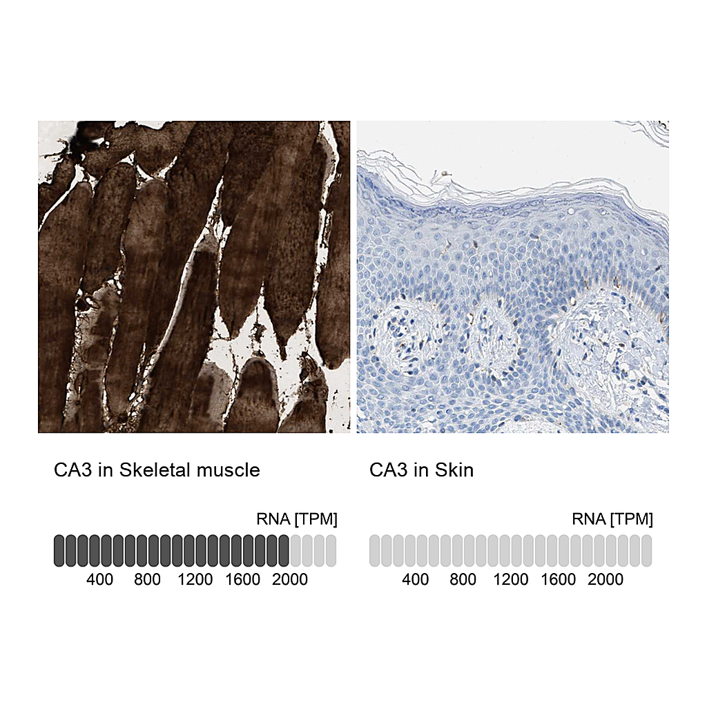 Atlas Antibodies Anti-CA3 Antibody