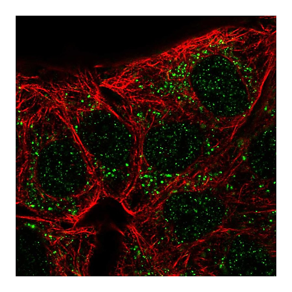 Atlas Antibodies Anti-CA10 Antibody