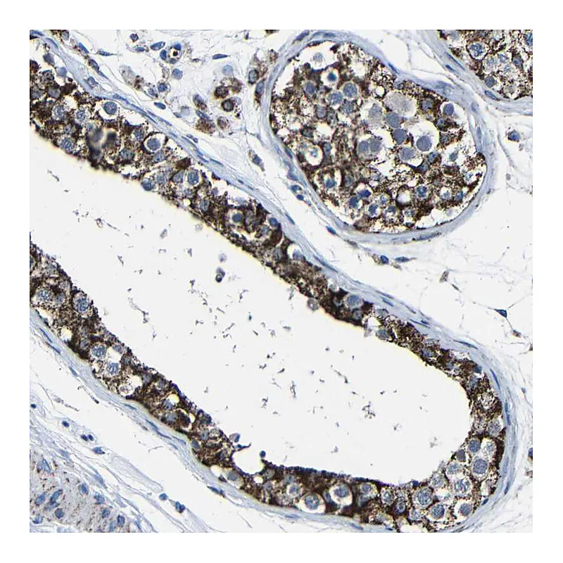 Atlas Antibodies Anti-CA5B Antibody