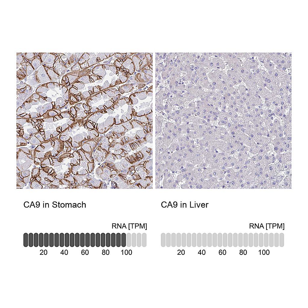 Atlas Antibodies Anti-CA9 Antibody