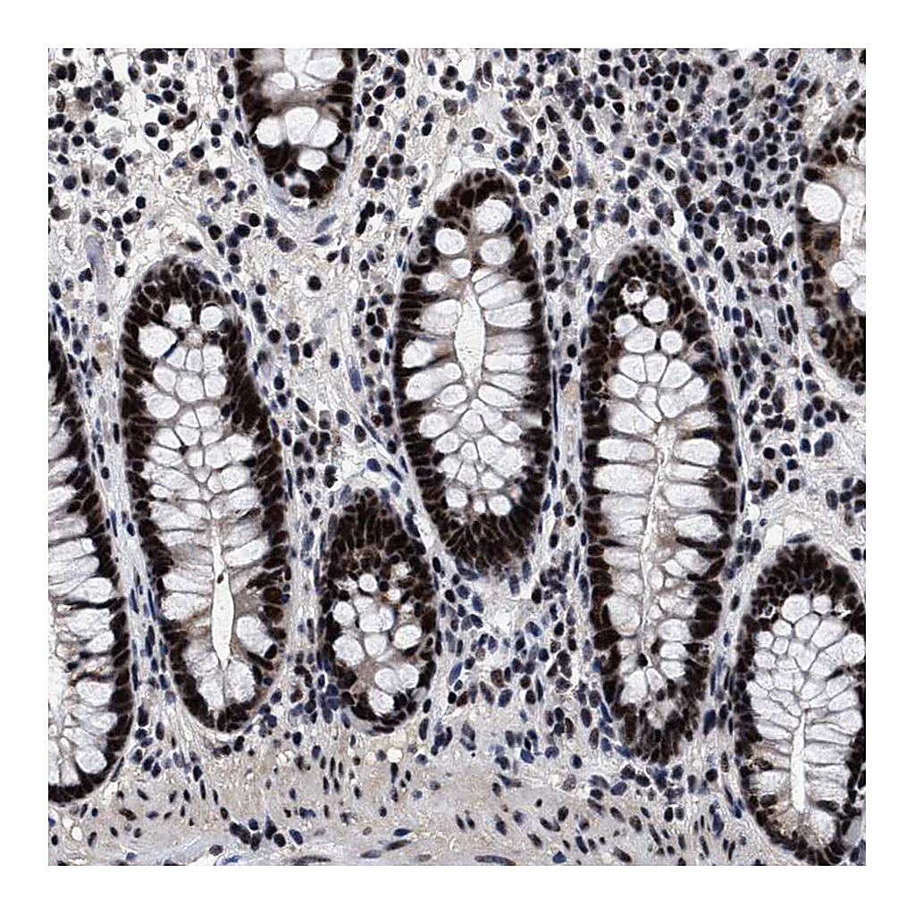 Atlas Antibodies Anti-CAAP1 Antibody