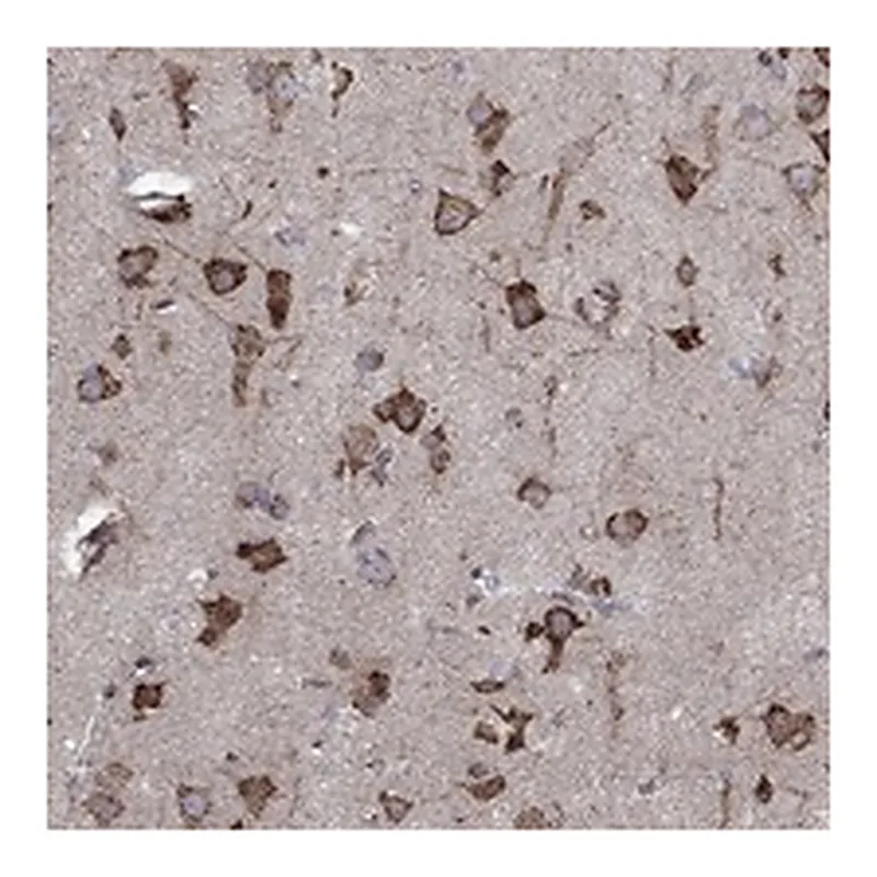 Atlas Antibodies Anti-CAB39L Antibody