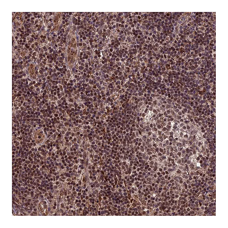 Atlas Antibodies Anti-CABIN1 Antibody