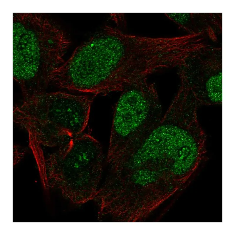 Atlas Antibodies Anti-CABLES1 Antibody
