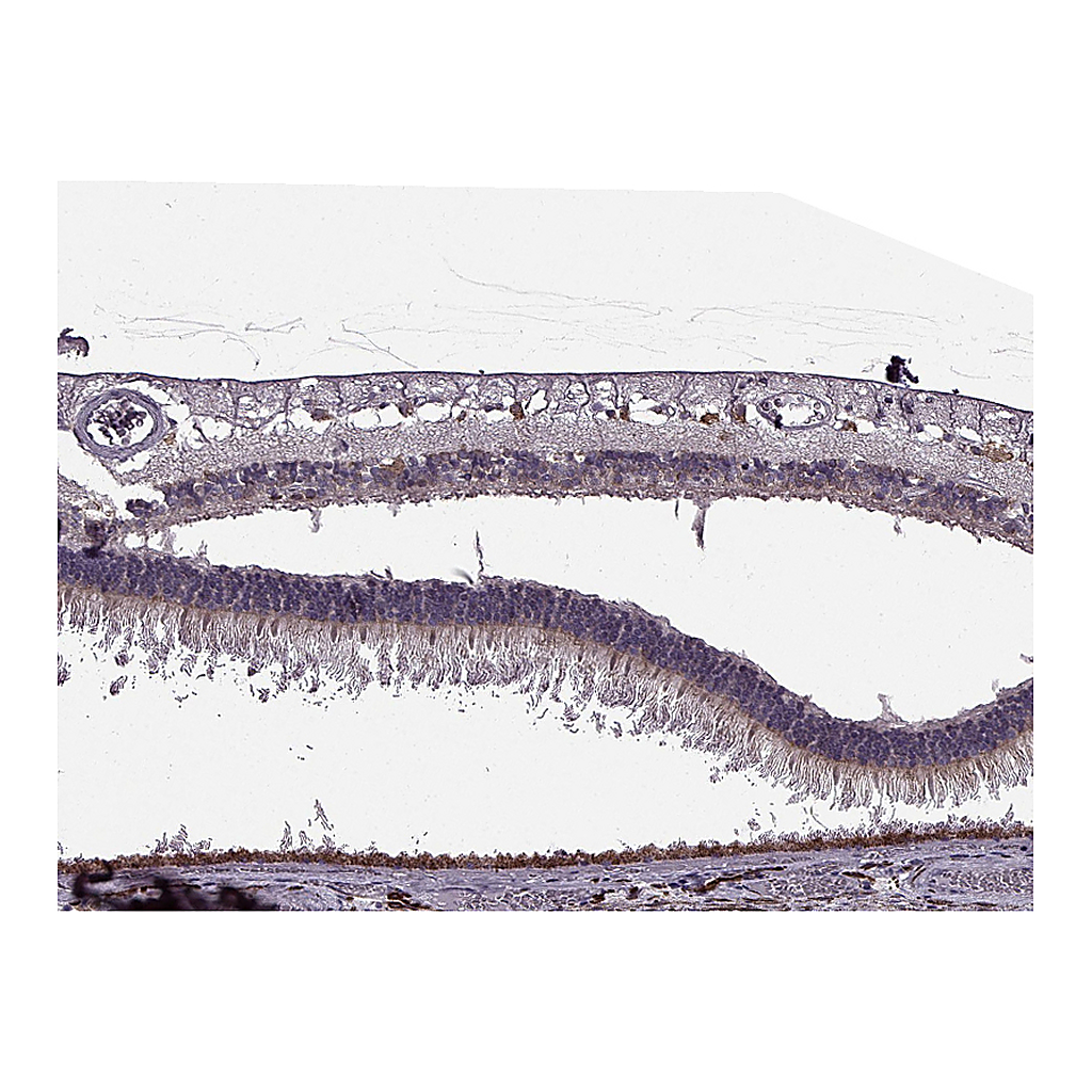 Atlas Antibodies Anti-CABP5 Antibody