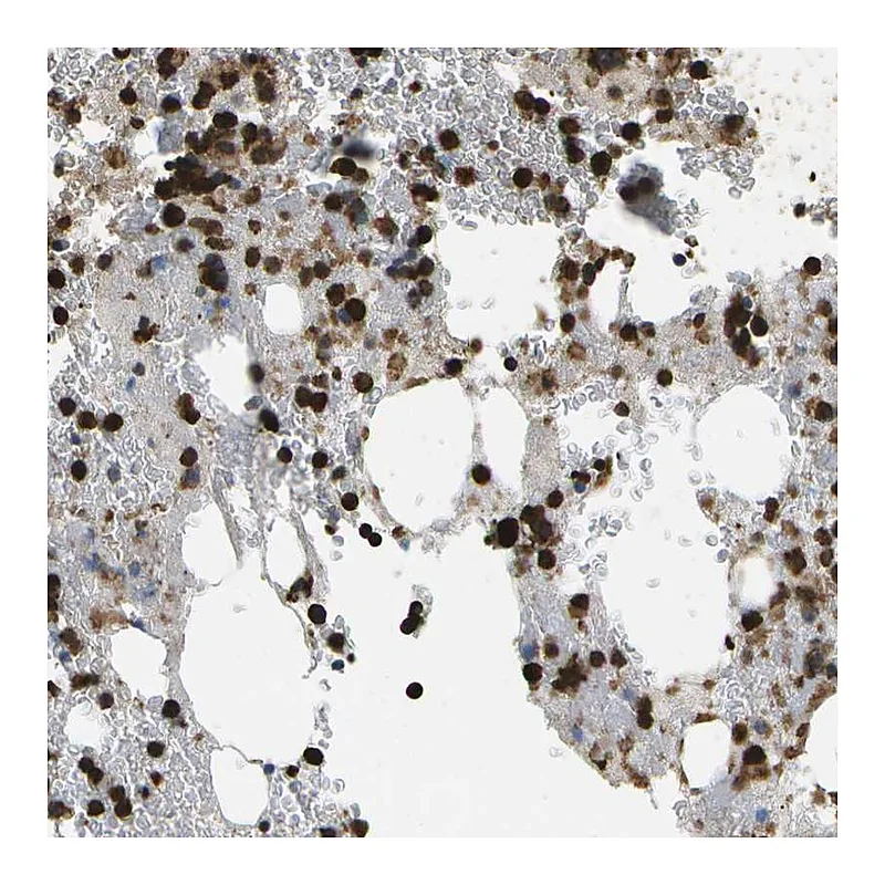 Atlas Antibodies Anti-CACHD1 Antibody