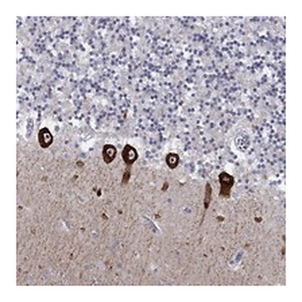 Atlas Antibodies Anti-CACNA1A Antibody