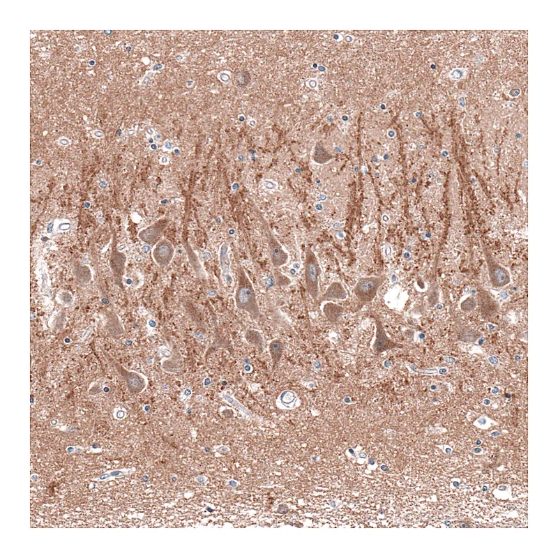 Atlas Antibodies Anti-CACNA1H Antibody