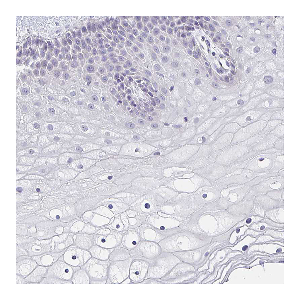 Atlas Antibodies Anti-CACNA1S Antibody