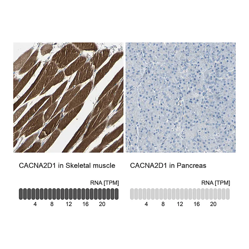 Atlas Antibodies Anti-CACNA2D1 Antibody