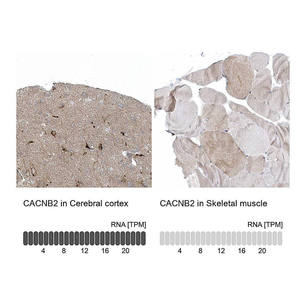 Atlas Antibodies Anti-CACNB2 Antibody