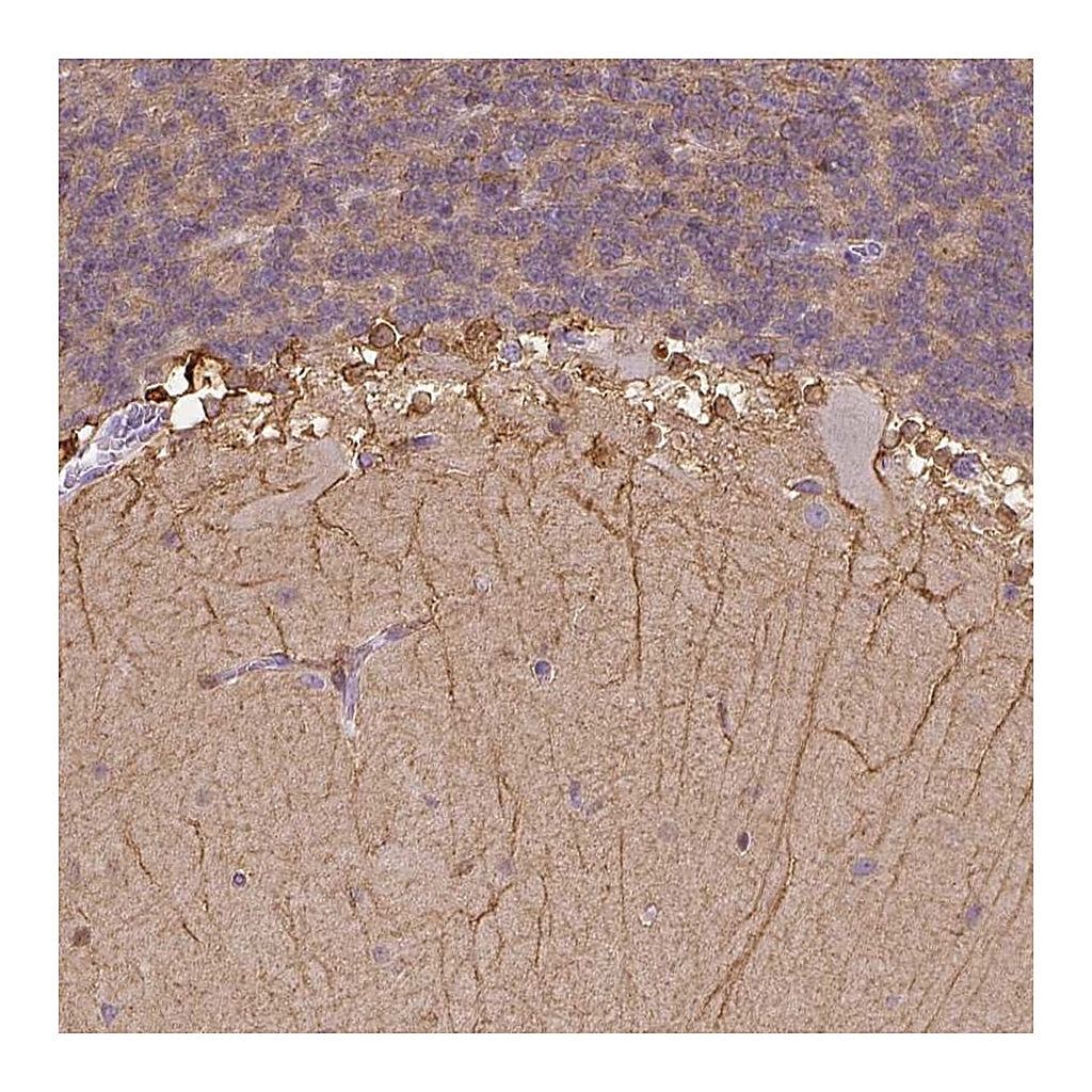 Atlas Antibodies Anti-CACNB1 Antibody