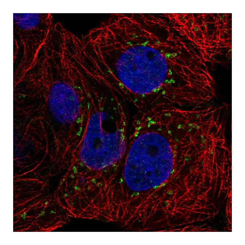 Atlas Antibodies Anti-CACNB3 Antibody