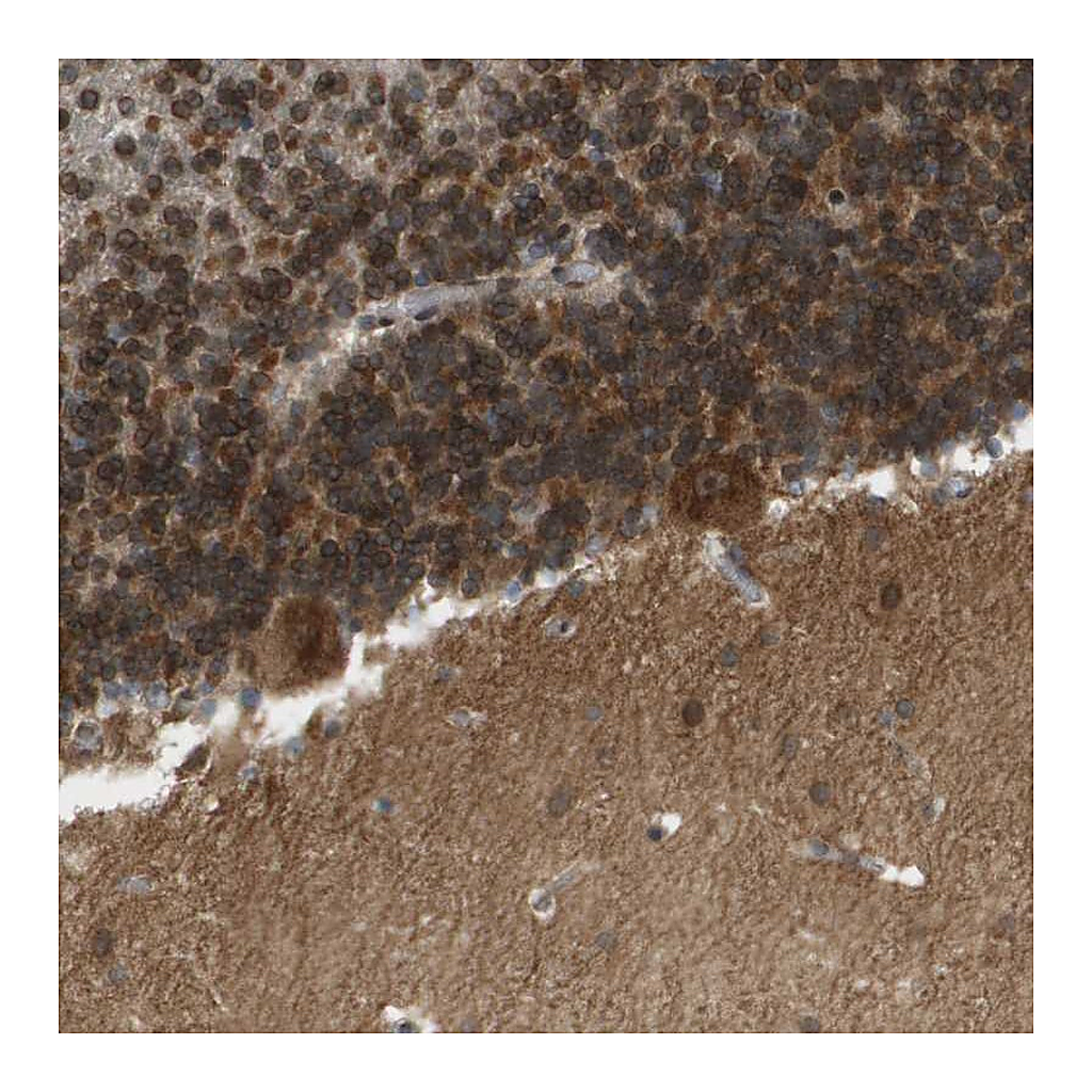 Atlas Antibodies Anti-CACNB4 Antibody
