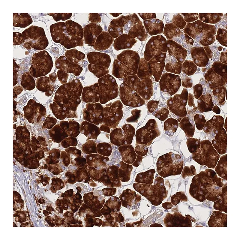 Atlas Antibodies Anti-CACNG5 Antibody