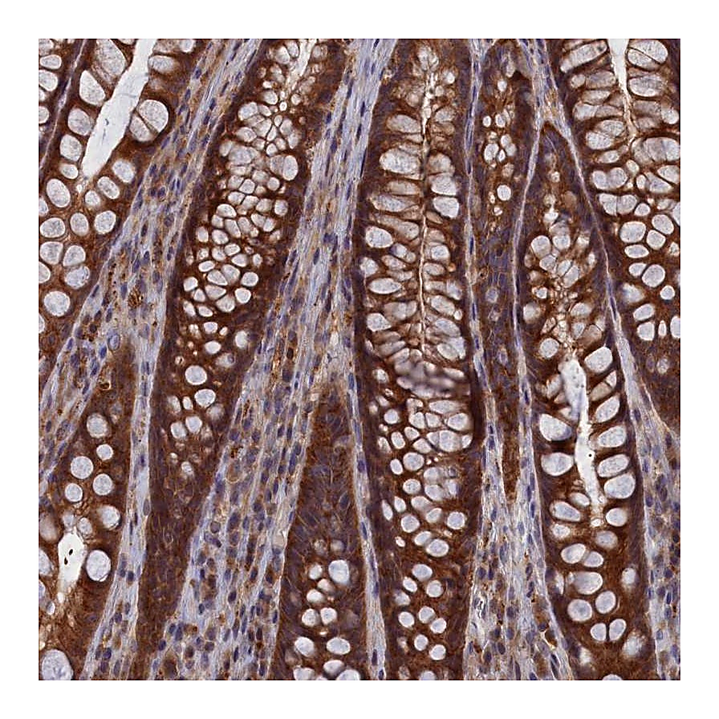 Atlas Antibodies Anti-CACTIN Antibody