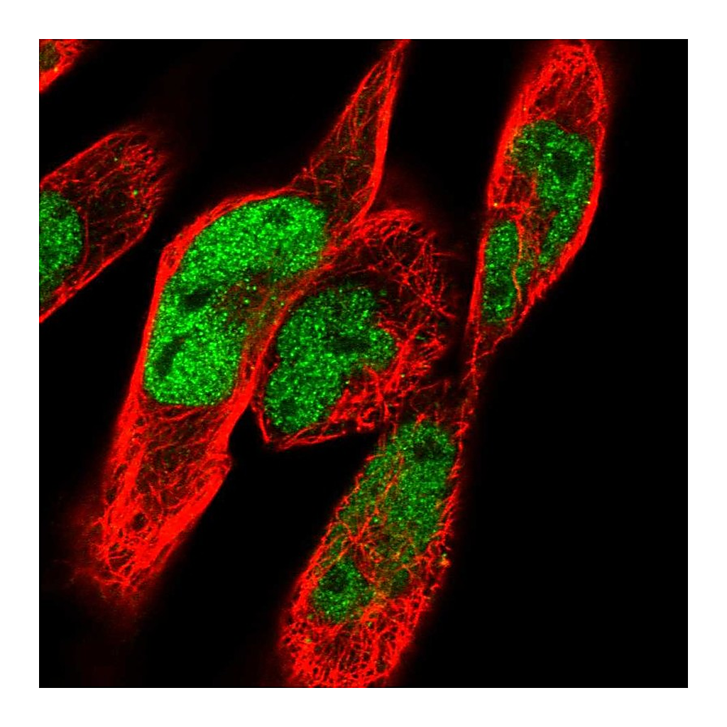 Atlas Antibodies Anti-CACUL1 Antibody