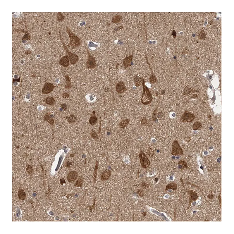 Atlas Antibodies Anti-CACYBP Antibody