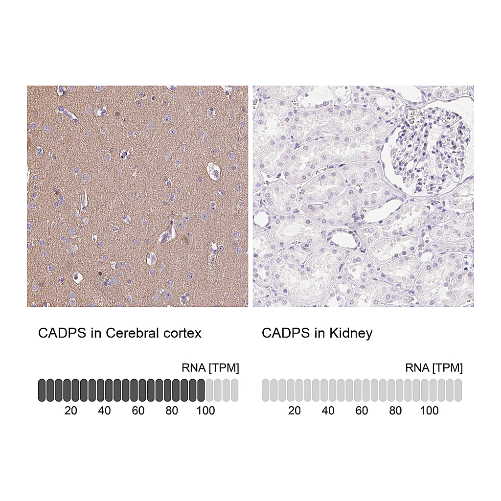 Atlas Antibodies Anti-CADPS Antibody