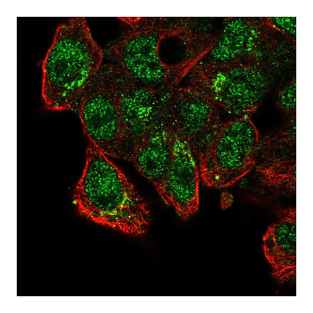 Atlas Antibodies Anti-CADPS2 Antibody