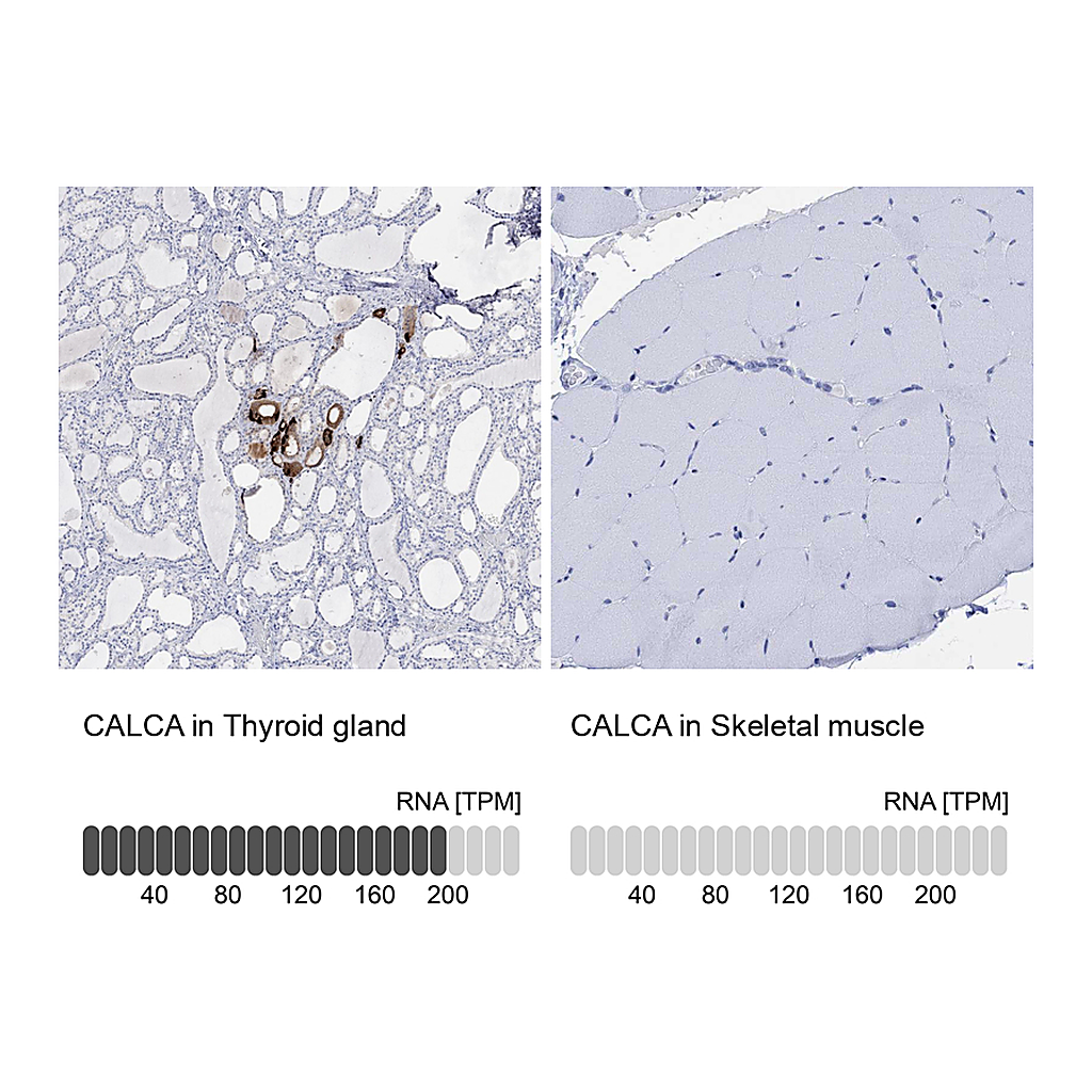 Atlas Antibodies Anti-CALCA Antibody