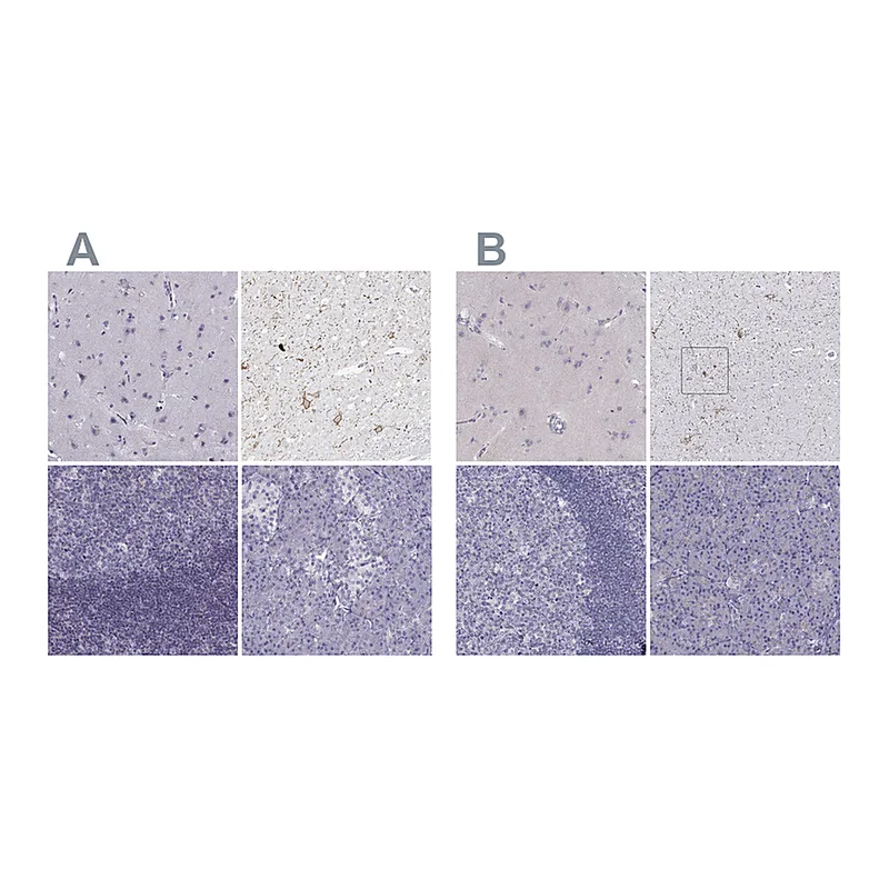 Atlas Antibodies Anti-CALCR Antibody