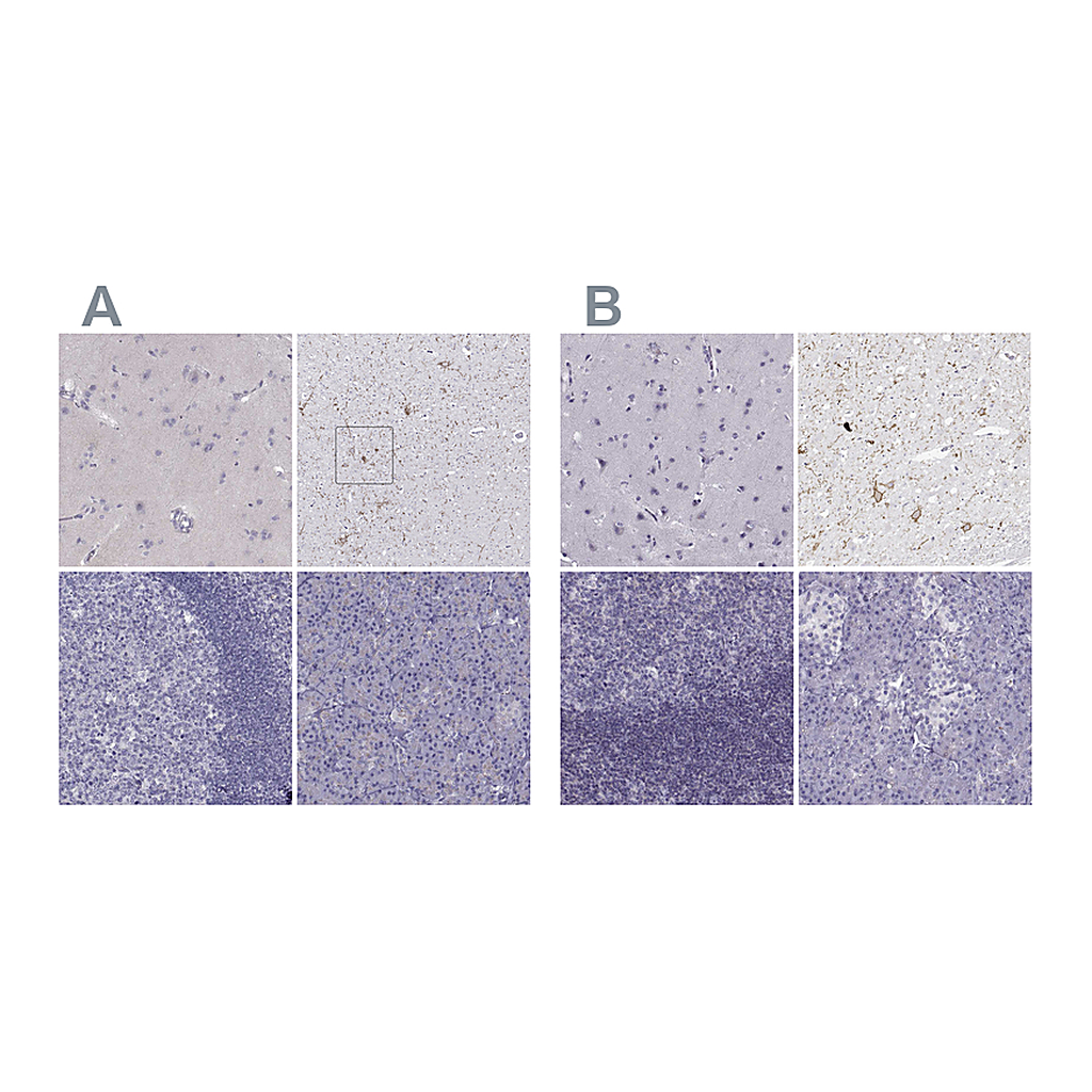 Atlas Antibodies Anti-CALCR Antibody