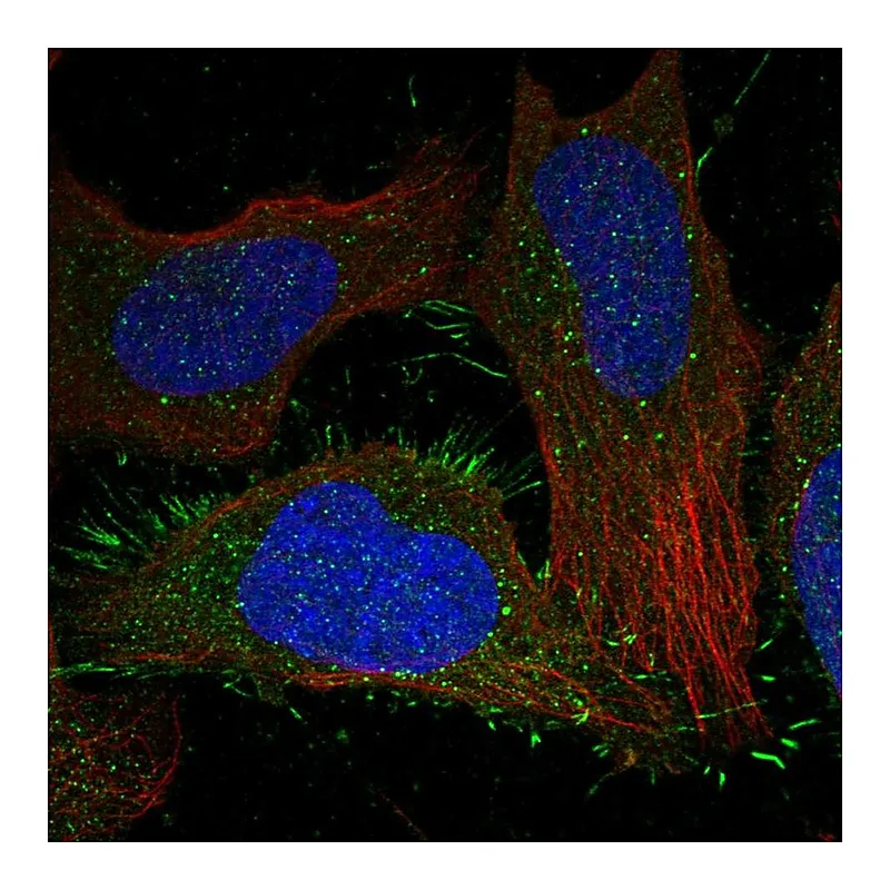 Atlas Antibodies Anti-CALCRL Antibody