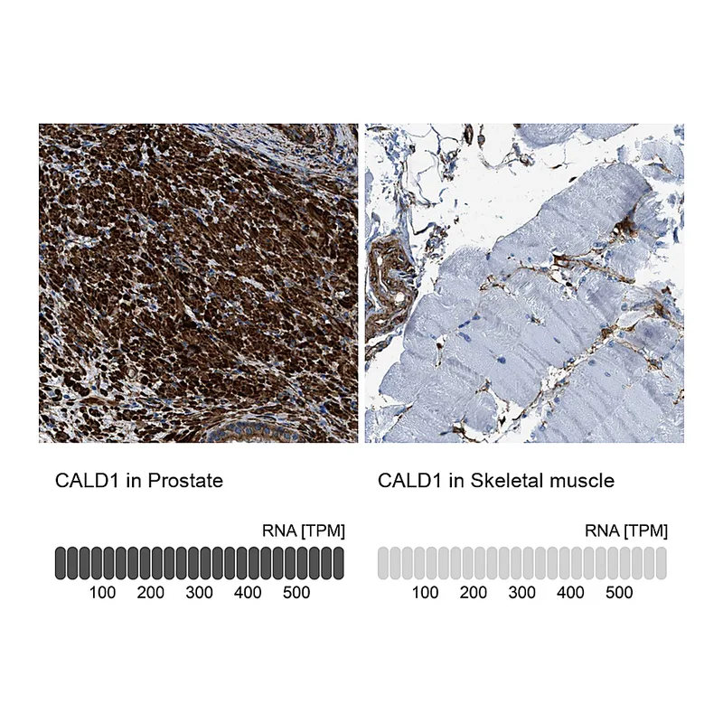 Atlas Antibodies Anti-CALD1 Antibody