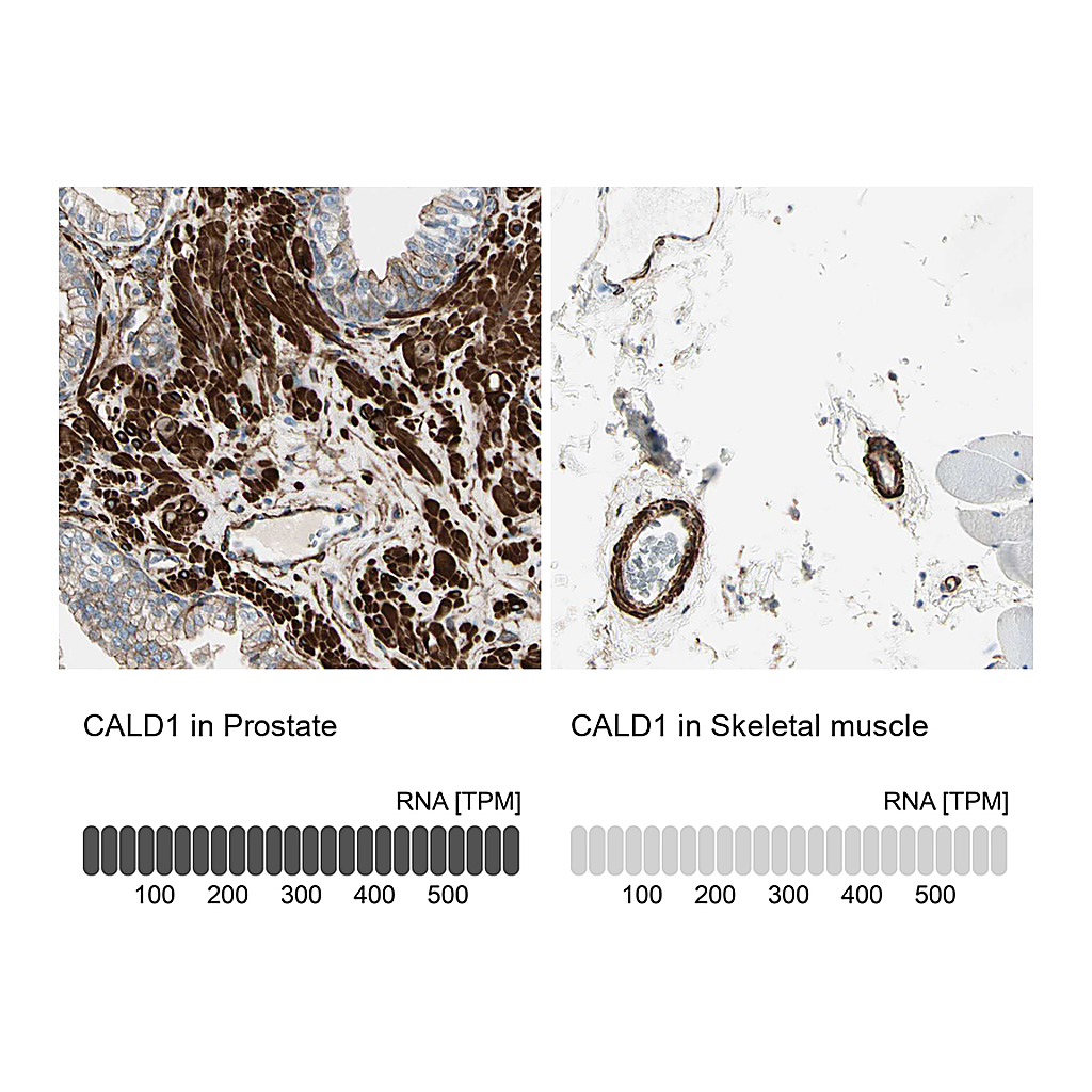 Atlas Antibodies Anti-CALD1 Antibody