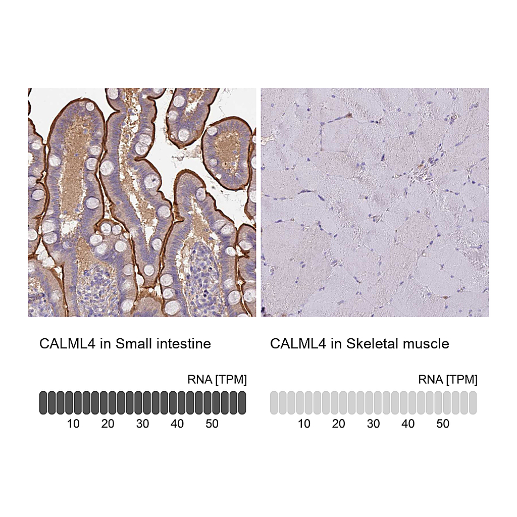Atlas Antibodies Anti-CALML4 Antibody