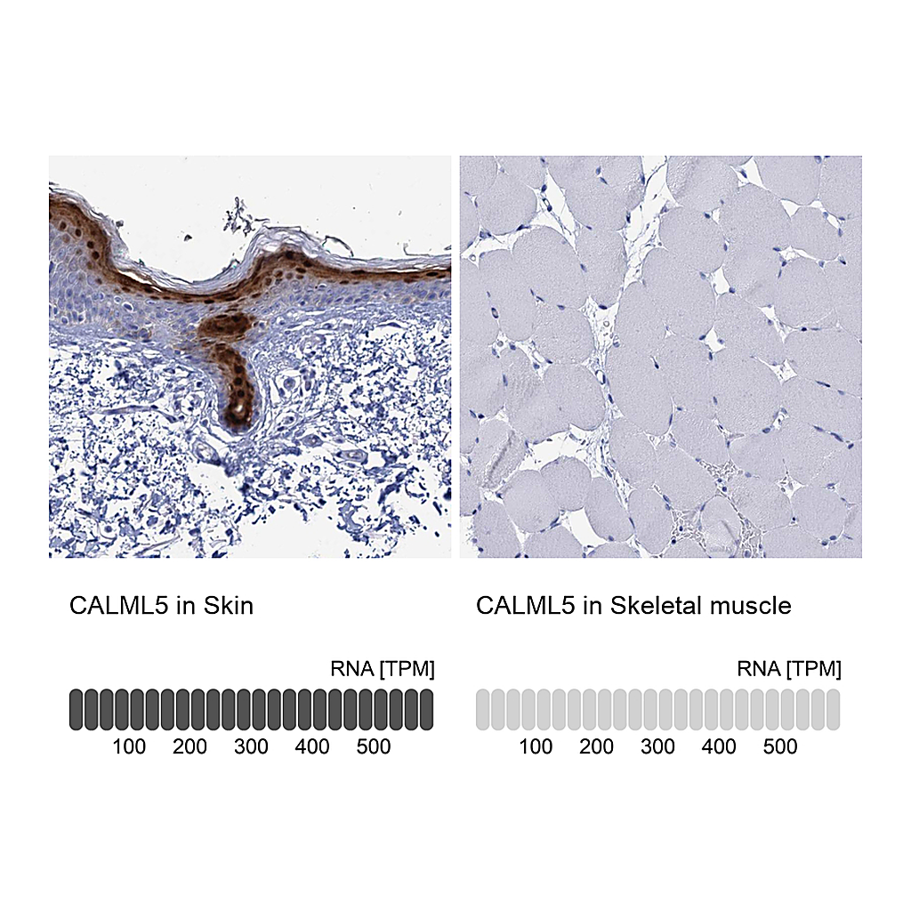 Atlas Antibodies Anti-CALML5 Antibody