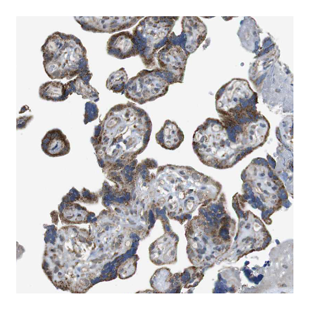Atlas Antibodies Anti-CALHM2 Antibody